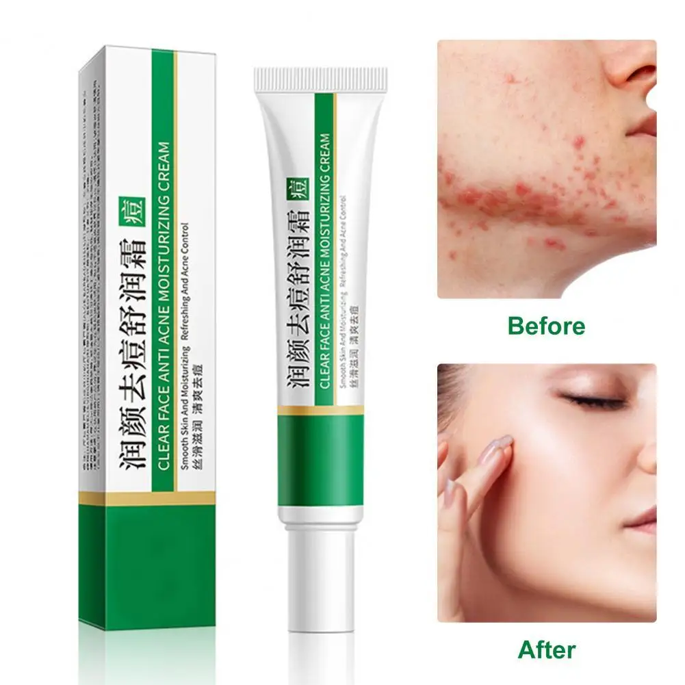 

Уход за кожей лица с экстрактом алоэ, 20 г