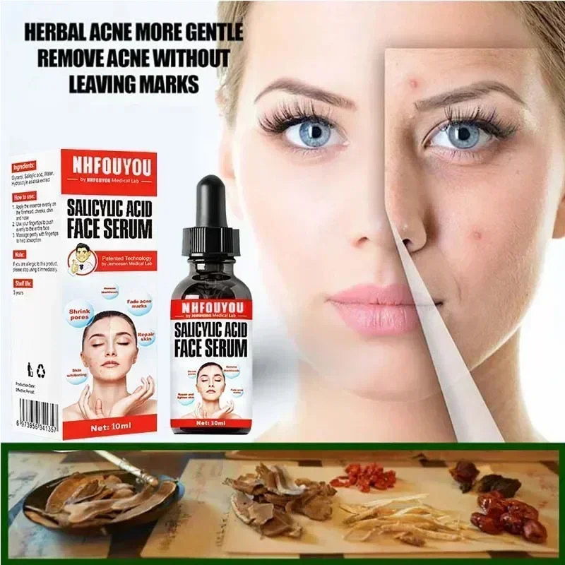 Раствор с салициловой кислотой 10 мл