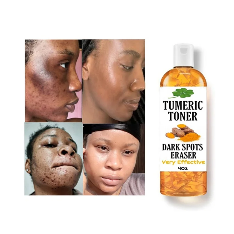 

100ml Tumeric Dark Spots Toner Facial Strong Lightening TurmericToner Spots Eraser for Even Skin Tone Flawless Skin Facial Toner