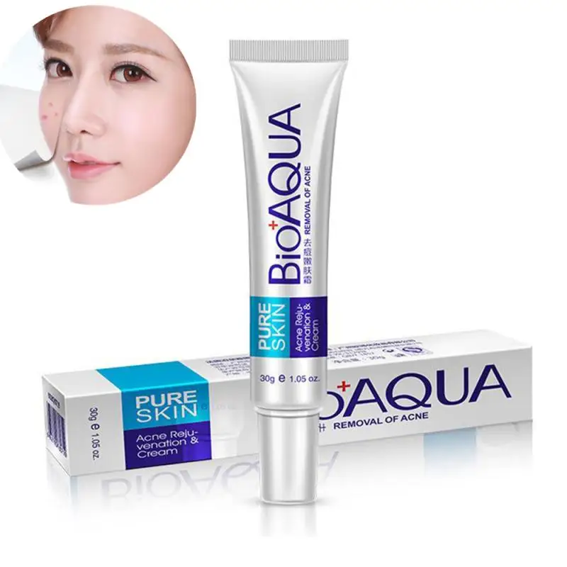 

Bioaqua Acne Treatment Cream Blackhead Removal Anti Acne Cream Oil Control Shrink Pores Acne Scar Remove Face Care Whitening