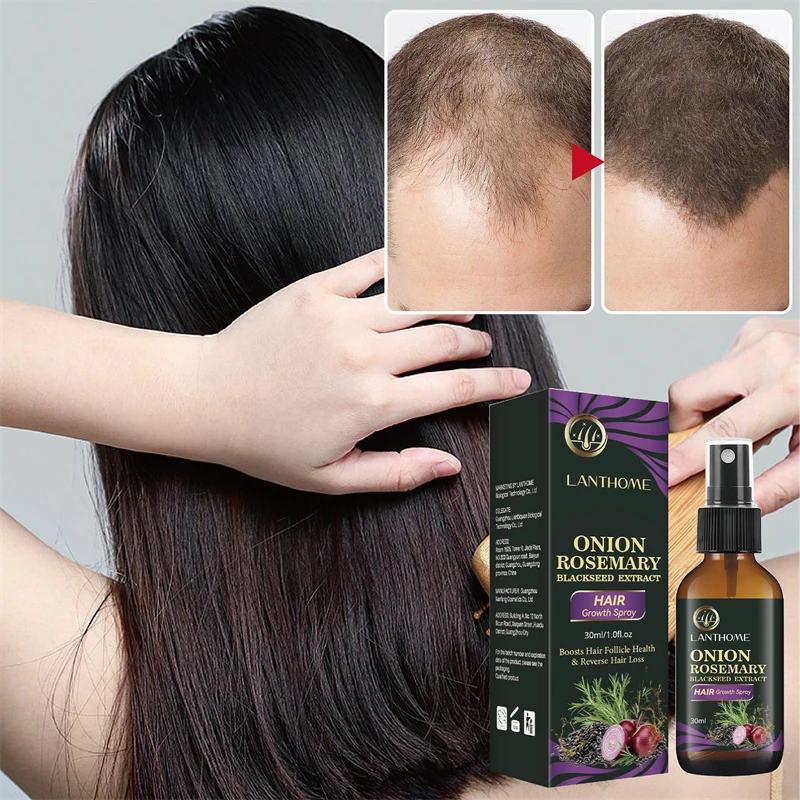 

Intense Hair Growth Essence Spray Onion Natural Hair Care Growth Anti-Hair Loss Serum Repair Nourish Hair Roots Scalp Treatment