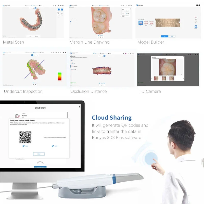 Портативный портативный цифровой внутриротовой сканер IOS 11 3D сканирование в