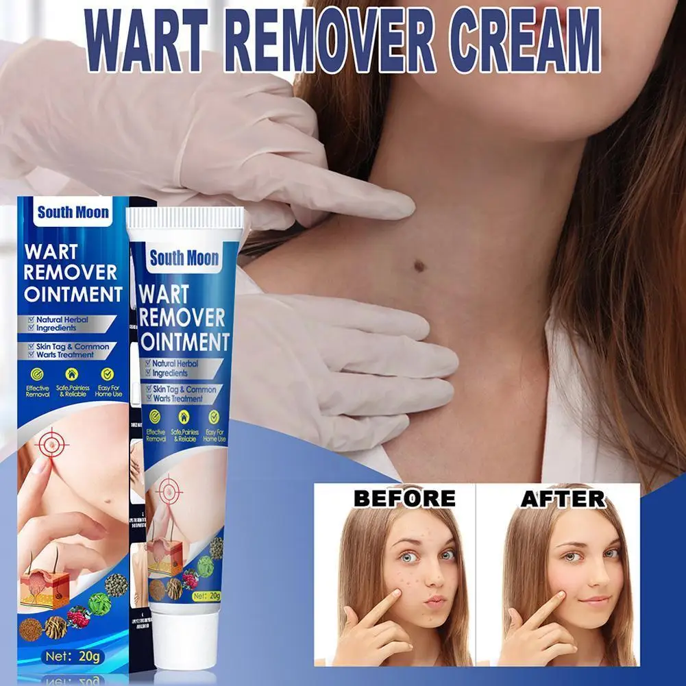 

Warts Remover Cream Skin Tag Remover Against Mole Antibacterial Wart Corn Plaster Treatment Ointment Extract Herbal Z4Q6
