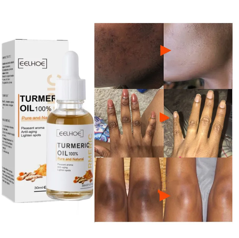 

30ml Turmeric Essential Oil Organic Tumeric Oil For Dark Spots 100 Pure Therapeutic Grade Turmeric Oil For Moisturizing