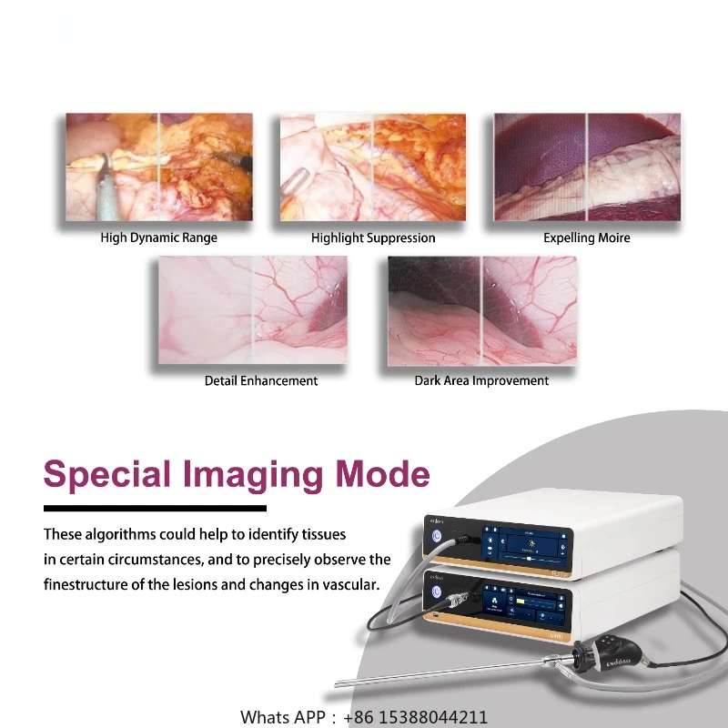 OEM ODM 4K UHD Медицинская видеоэндоскопическая камера эпохи для лапароскопической