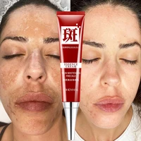 1pc whitening freckle cream remove chloasma dark spots melanin melasma brighten moisturizing anti freckle face skin care gel 20g
