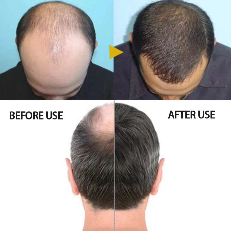 Сыворотка для роста волос с имбирным маслом 30/60 г |