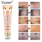 Крем Yoxier для восстановления рубцов лаванды, восстанавливающий, удаляющий ожоги рубцы, способствует регенерации клеток, повышает эластичность, уход за кожей, Лидер продаж