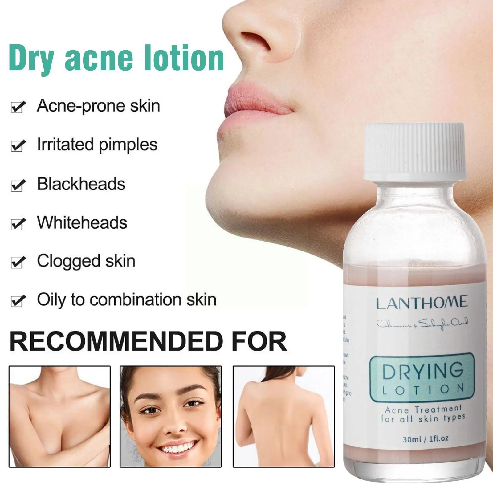 

Сыворотка для удаления акне с салициловой кислотой, 30 мл