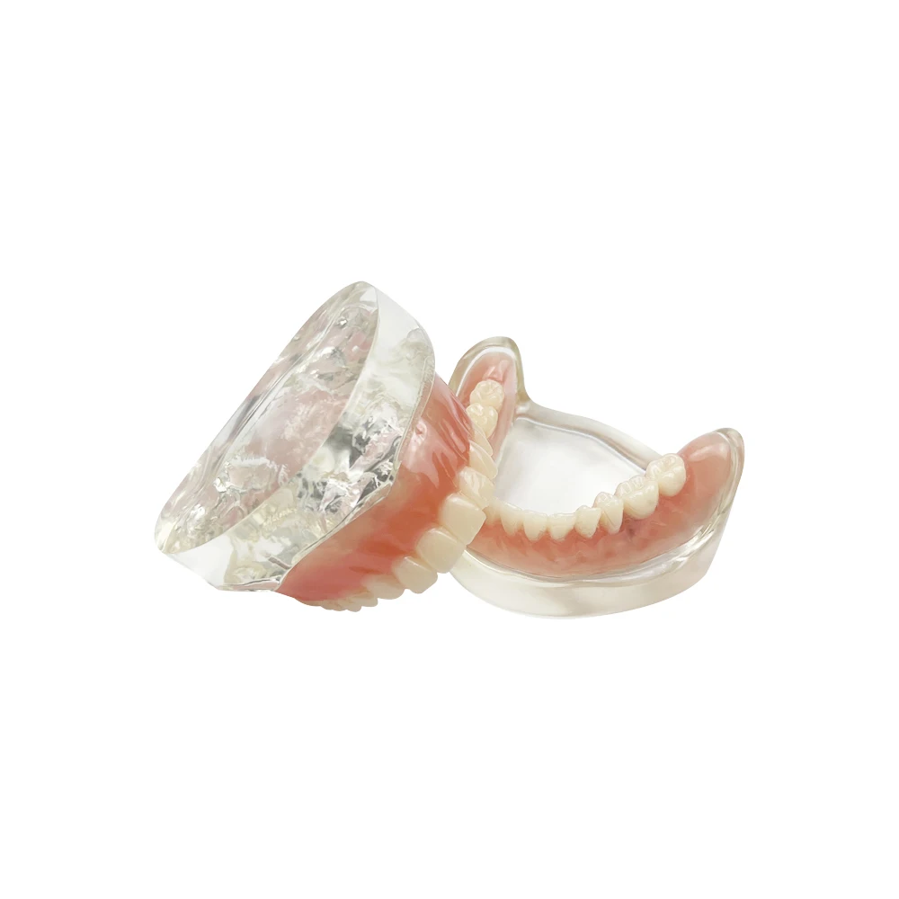 1 комплект съемный адсорбционный зуб для зубного имплантата верхняя нижняя часть