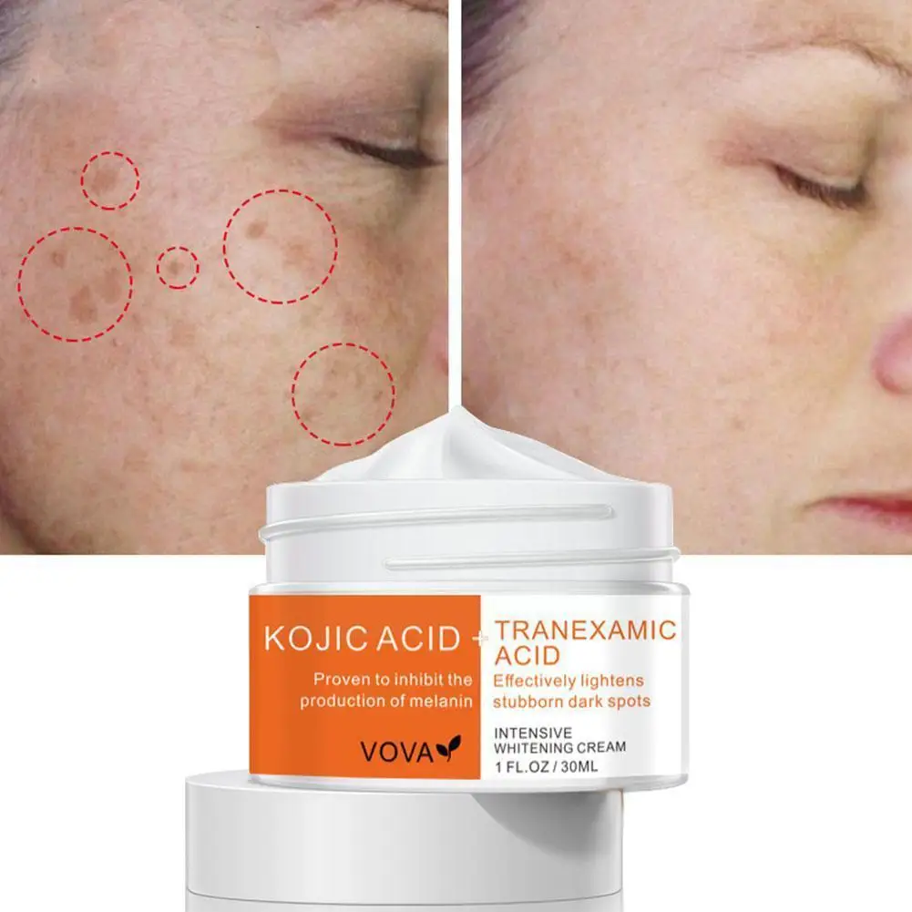 

30g New Whitening Cream Remove Dark Spots Pigment Fade Cream Whiten Spot Acne Removal Melasma Melanin Skin Care Freckle U6c5