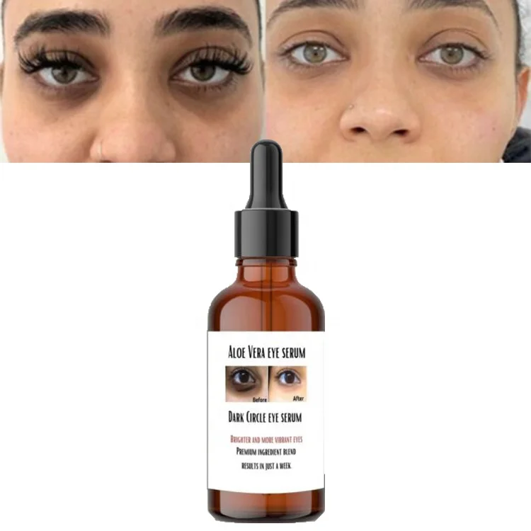 15 мл средство для осветления кожи под глазами с алоэ вера ластик темными кругами