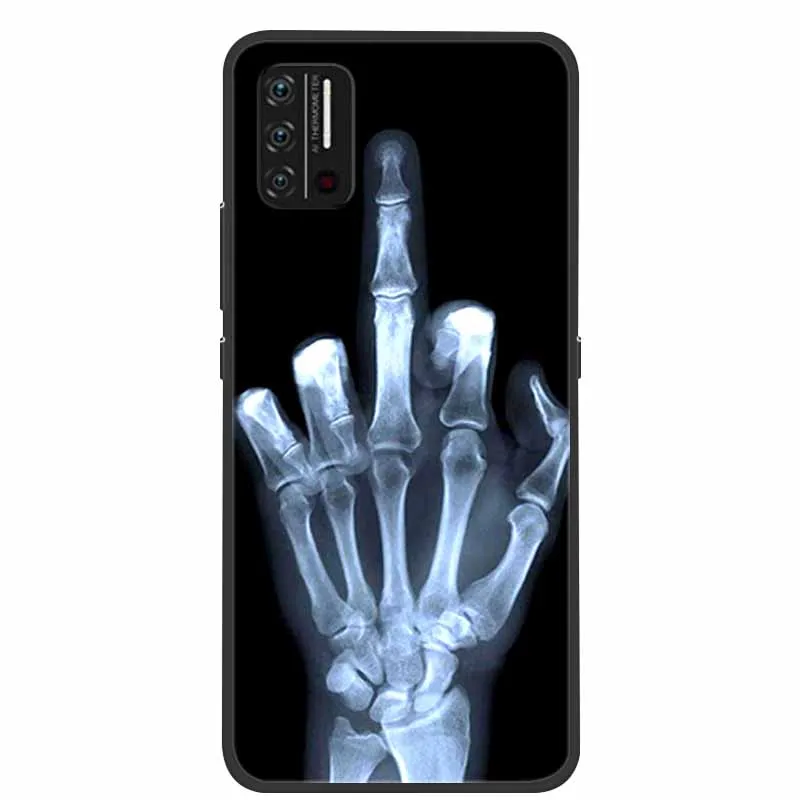 for umidigi a7s case a7 pro wolf silicone tpu soft cover phone case for umidigi a7 pro shockproof bumper animals coque funda free global shipping