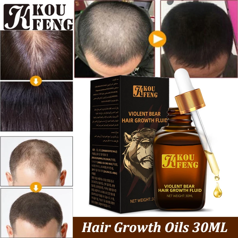 KouFeng мощная Сыворотка для роста волос против выпадения лечение - Цена: 5840.53