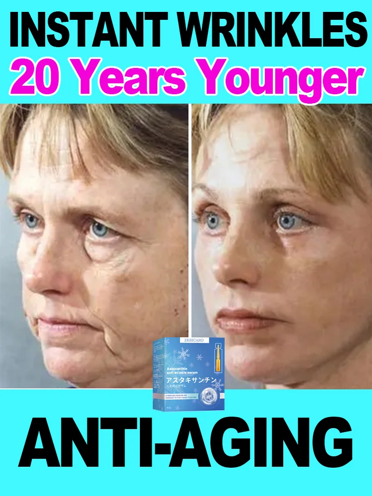 Эс-сенция п-ротив мор-щин мгнове-нное удале-ние морщ-ин про-тив стар-ния