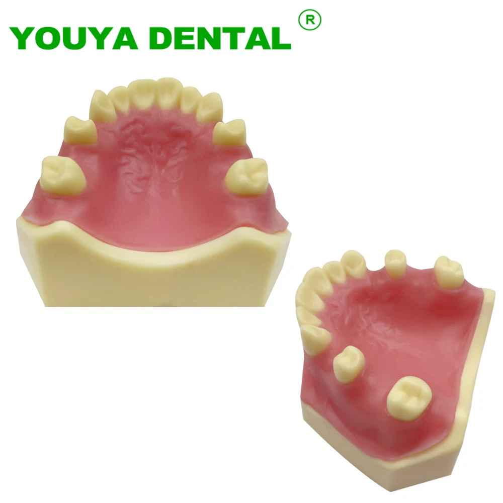 

Dental Teeth Model Implant Practice Typodont Demonstration Tools Dentist Student Studying Teaching Models Dentistry Products