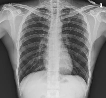 Ruiba 2024Новые продукты Ручная высокочастотная цифровая портативная мобильная