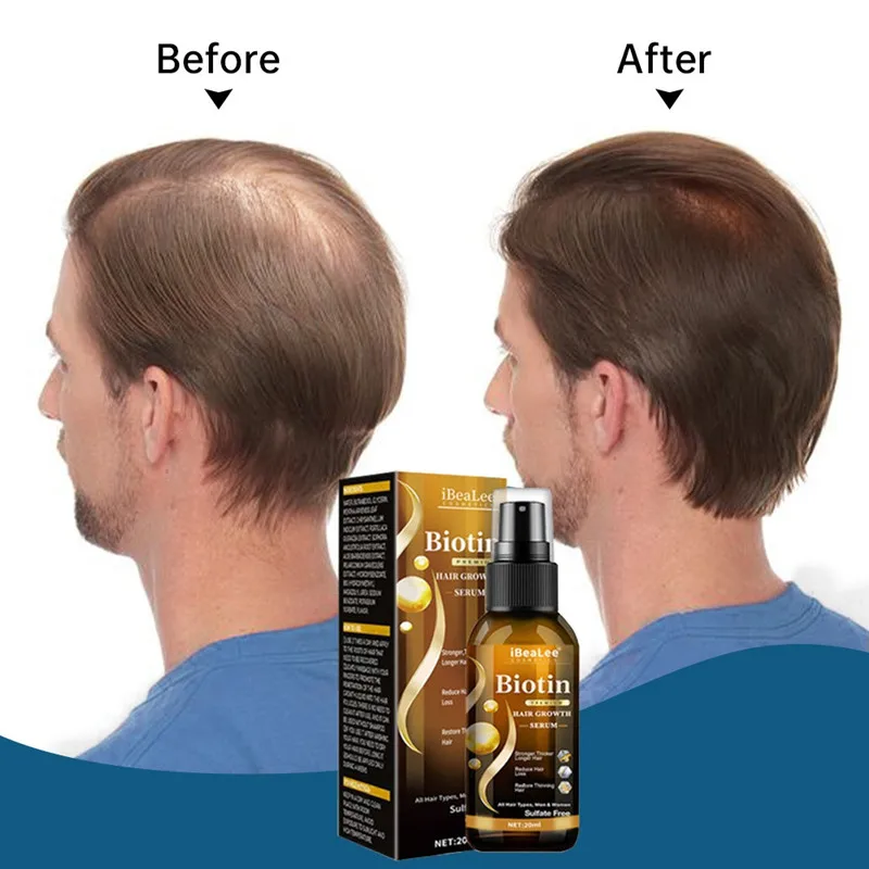 Effective Hair Growth Serum Anti Hair Loss Essence Oil Spray Repair Scalp Nourish Hair Roots Treatment For Men Women Hair Care