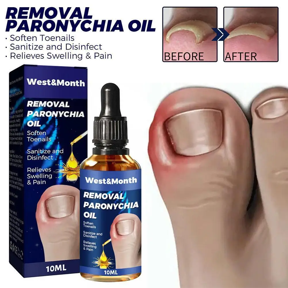 

10ml Nail Fungal Treatment Feet Care Essence Anti Infection Onychomycosis Toe Fungus Nail Paronychia Removal Foot Solution L5N6