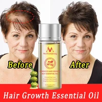 20ml fast hair growth essential oil products hair loss treatment serum care prevent dry frizz repair damage nourish hair root