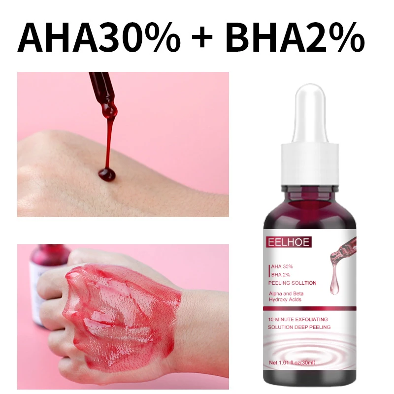 

Face Peeling Solution AHA 30% + BHA 2% Fruit Acid Salicylic Acid Acne Removing Serum Repair Hyaluronic Acid Face Skin Care 30ml