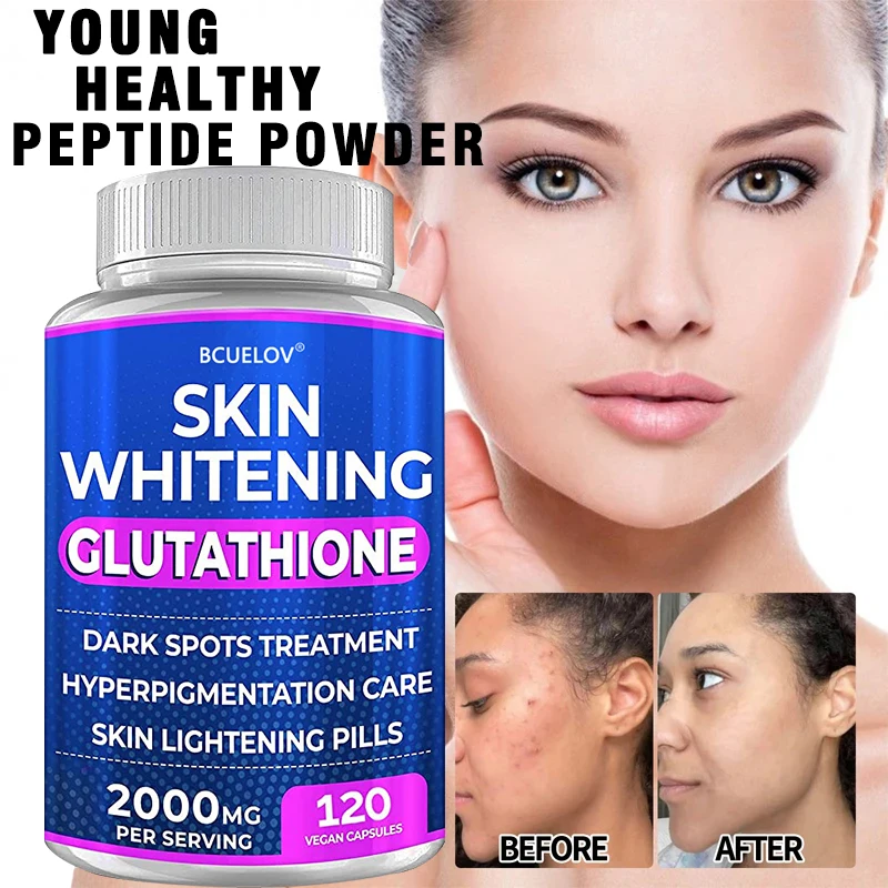 

Bulova Intense Whitening Supplement To Remove Dark Spots and Acne Scars, Treat Hyperpigmentation - Anti Aging Anti Oxidant