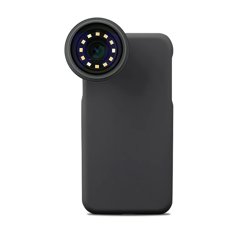 

Mobile Handscope 10X Magnifying Glass Lens Medical Dermatoscope Dermoscope