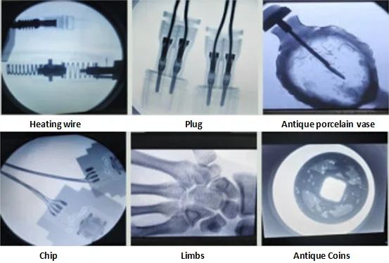 Ручной рентгеновский флюороскопический аппарат Hyperlight Portable Xray Digital