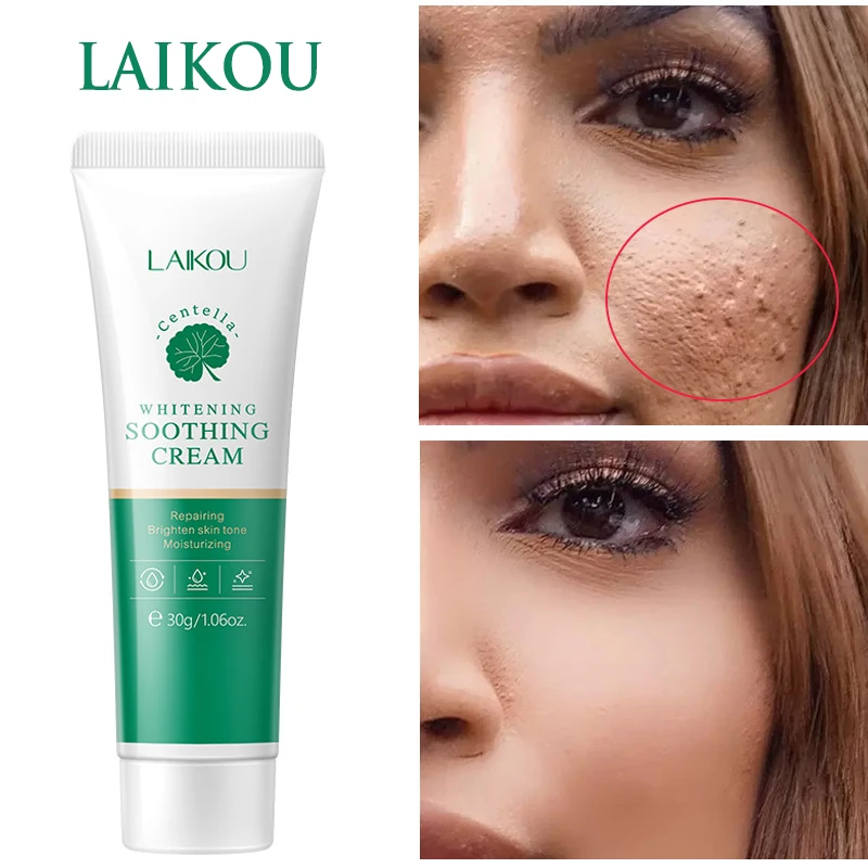 

Крем для ухода за кожей лица с черными точками