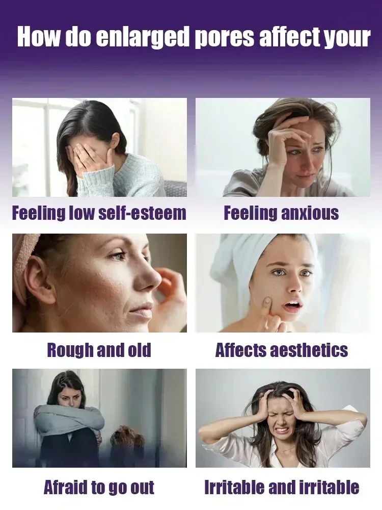 Сыворотка для минимизации пор кислота сужение удаление больших черных точек