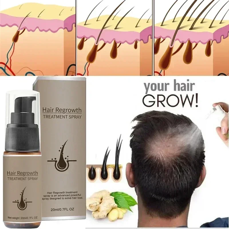 HOT SALE Fast Hairs Growth Oil Baldness Repair Hereditary Hair Loss Postpartum Seborrheic Hai