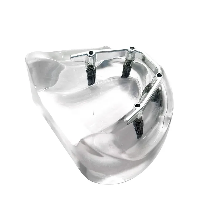 Зубной имплантат модель зубов 4 имплантаты зубной протез серебряный стержень