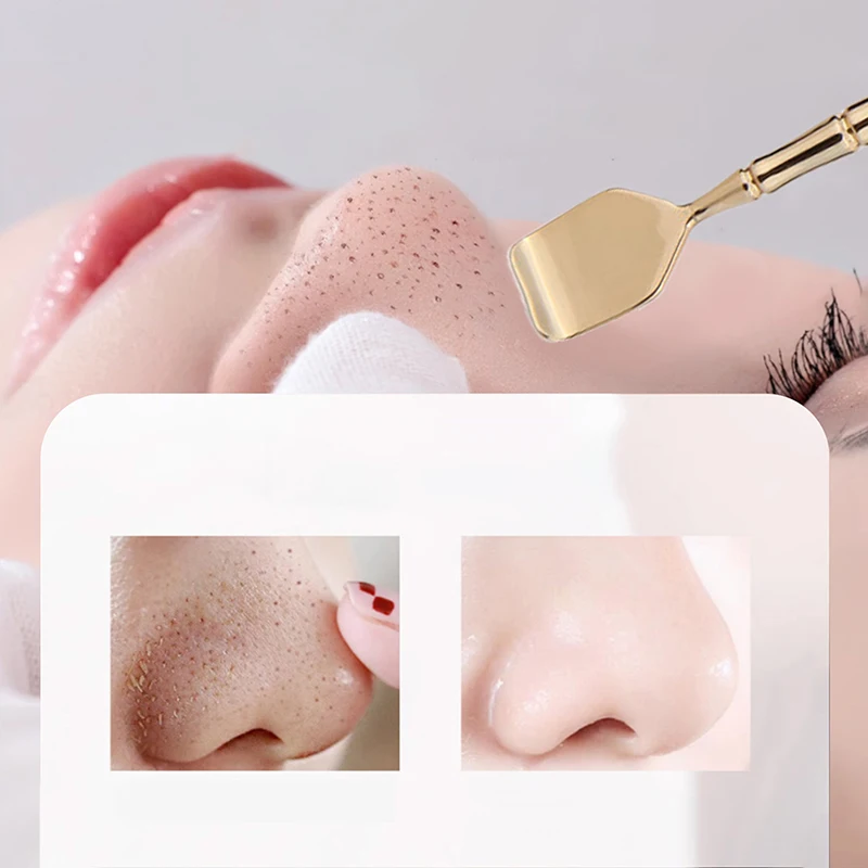 Средство для удаления черных точек из нержавеющей стали поппер прыщей игла