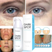powerful freckle whitening cream can remove acne melanin and black spots stretch the face tighten and protect skin