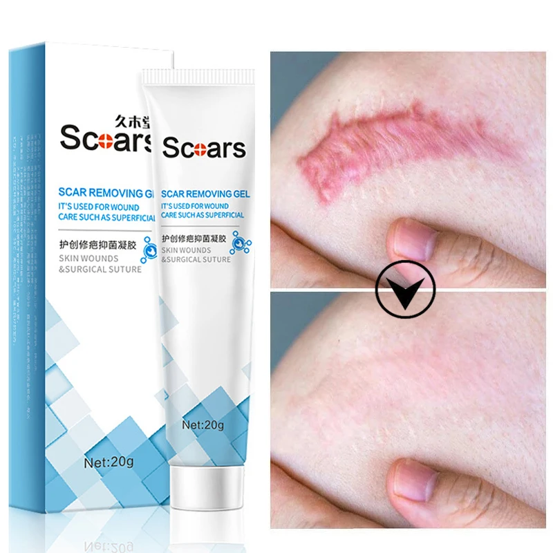 

Herbal Scar Removal Cream Repairing Gel Treatment Acne Burn Surgical Scar Cesarean Scar Smooth Stretch Marks Face Body Skin Care