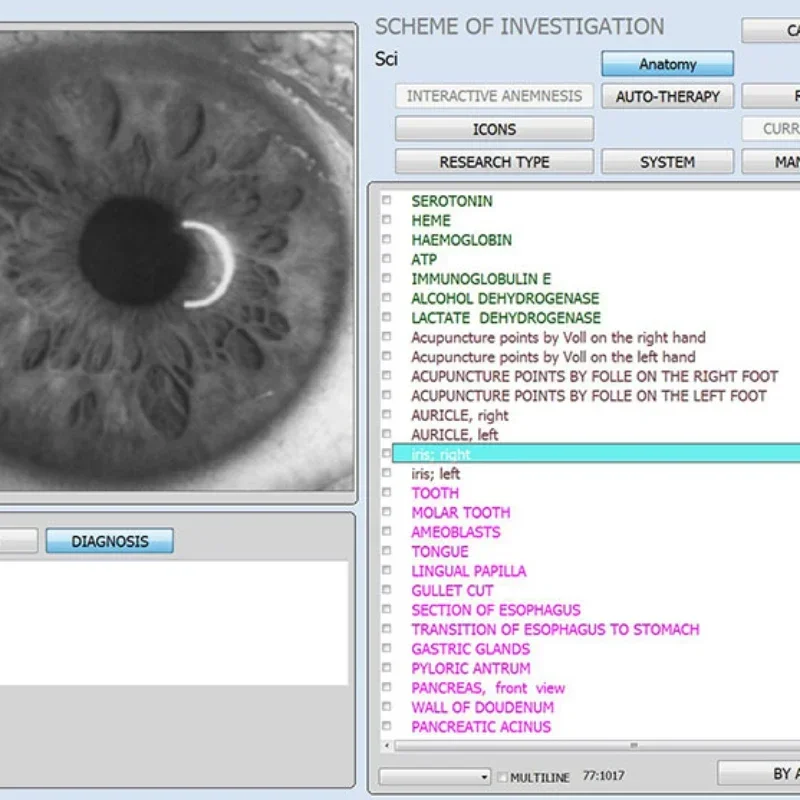 Новейший анализатор здоровья 12d nls аппарат для проверки aura