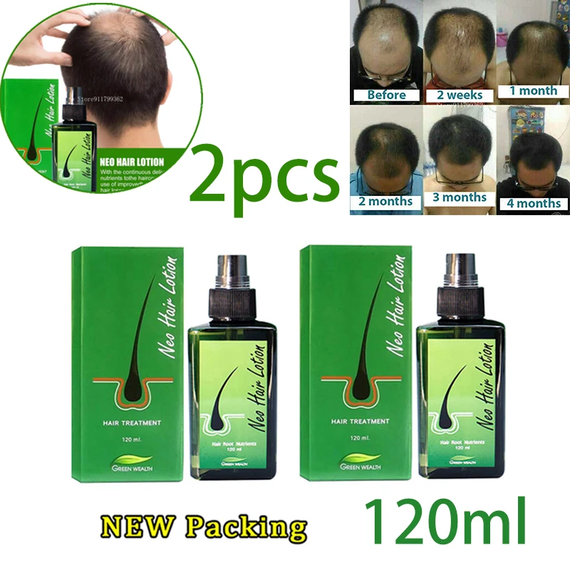 

2pcs Original 120ml Neo Hair Kit Lotion Hair Root Hair Beard Herbs Treatment 100% Original Nature Essence For Hair Growth Oil