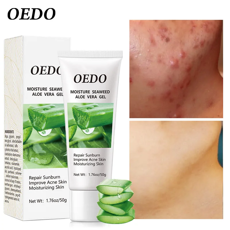 

2PCS/LOT Seaweed Aloe Vera Gel Hydrating Whitening Day Creams Acne Anti Aging Wrinkle Collagen Whitening Facial Cream Skin Care