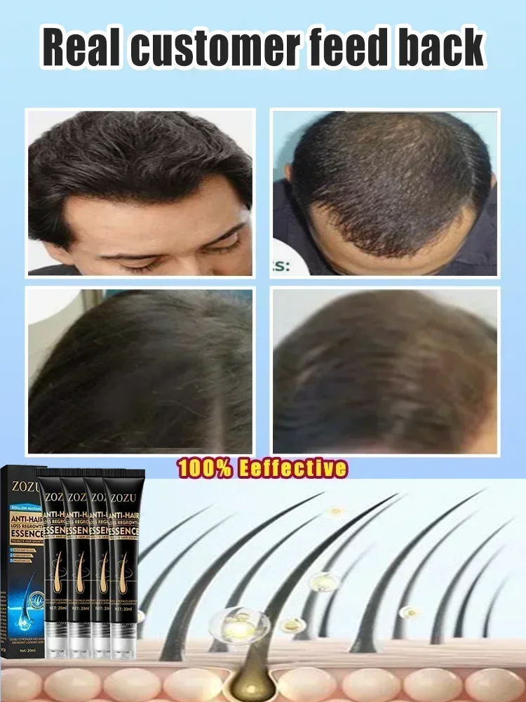 Сыворотка для защиты головы от выпадения волос