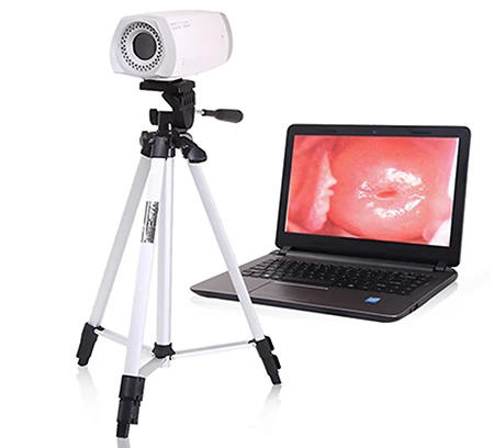 

Digital Video Colposcope Portable Colposcope For Gynaecology