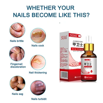 Nail Fungal Treatment Serum Onychomycosis Paronychia Anti Infection Toe Fungus Hand Foot Removal Repair Gel Care Beauty Health 3