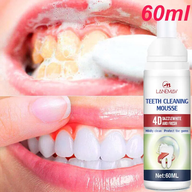 

Teeth Whitening Mousse Toothpaste Dental Bleaching Remove Plaque Stains Oral Hygiene Cleansing Fresh Breath Dentistry Care Tools
