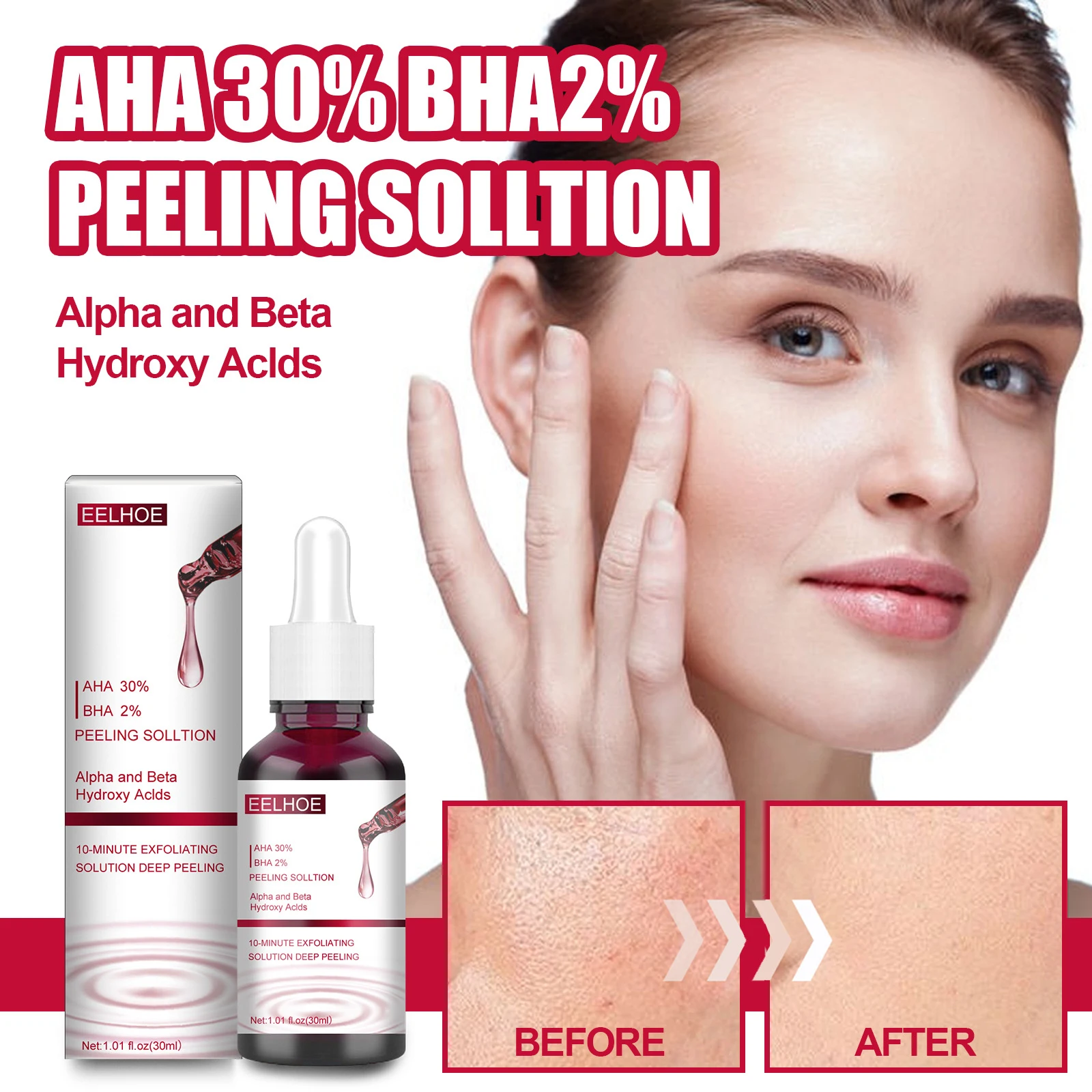 Solución exfoliante facial AHA 30% + BHA 2%, suero reparador para el cuidado de la piel del rostro, ácido salicílico, ácido hialurónico, 30ml