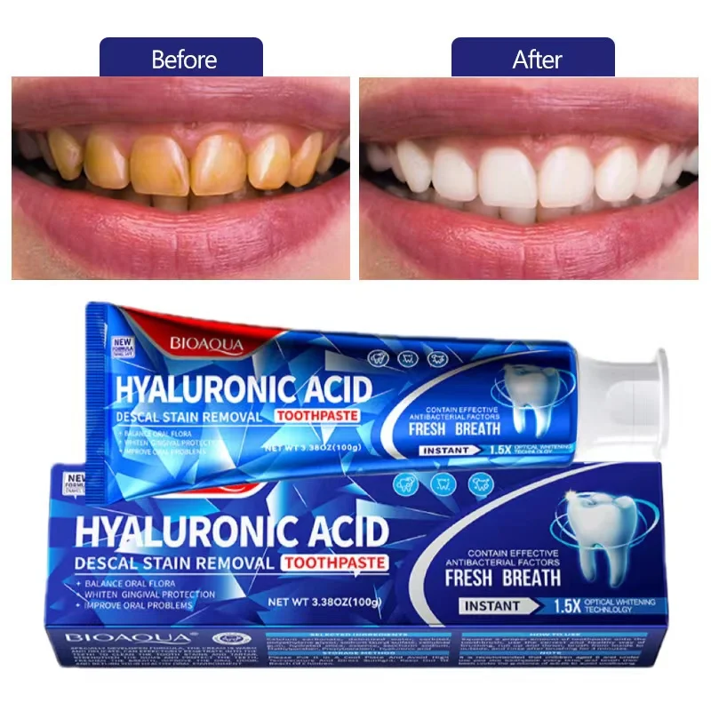 

Teeth Whitening Toothpaste Oral Hygiene Cleaning Remove Plaque Stains Yellow Tooth Fresh Breath Dental Bleach Health Care Tools