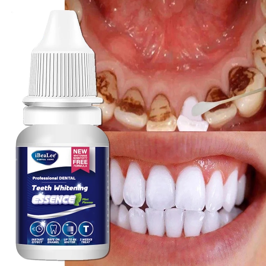 Teeth Whitening Serum Essence Remove Plaque Stains Bleaching Yellow Teeth Cleaning Oral Hygiene Powder Dental Care Beauty Health