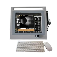 ab 1000 quantel same software ophthalmic ultrasound a scan ab scanner