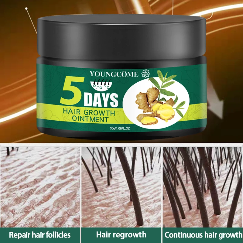 YOUNGCOME 60g 5 Days Hair Growth Ointment Promote Blood Circulation Protect Loss Control Oil Products |