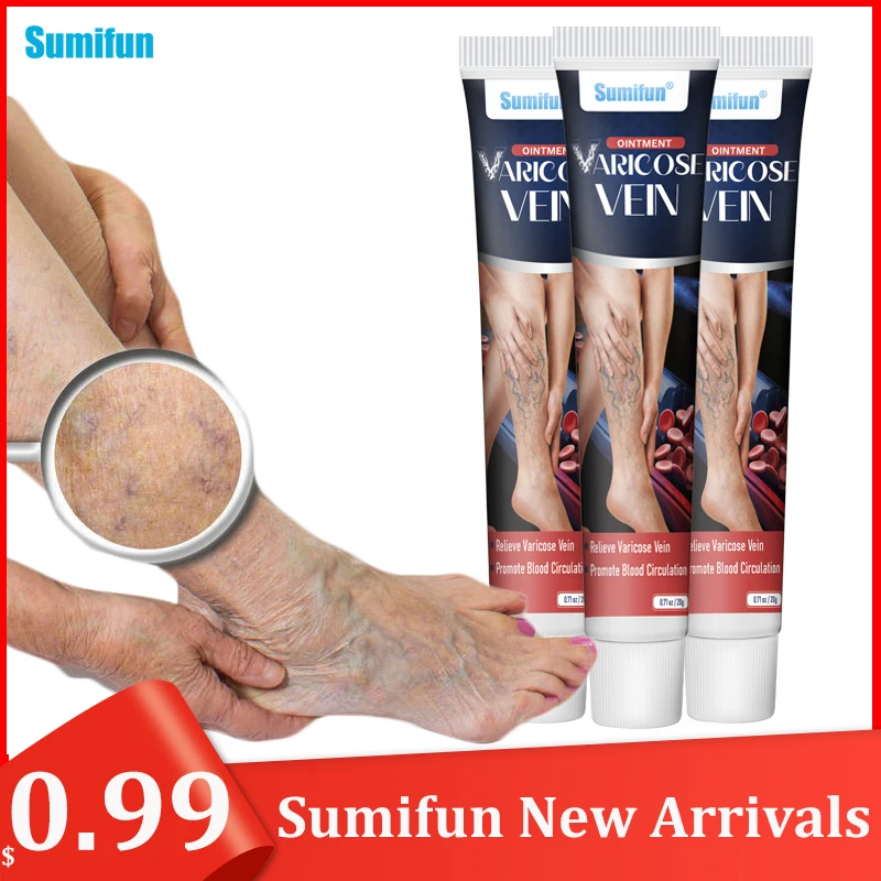 

Only$0.99 Sumifun New Varicose Vein Cream Phlebitis Vasculitis Spider Removal Plaster Varicosity Angiitis Pain Relief Ointment