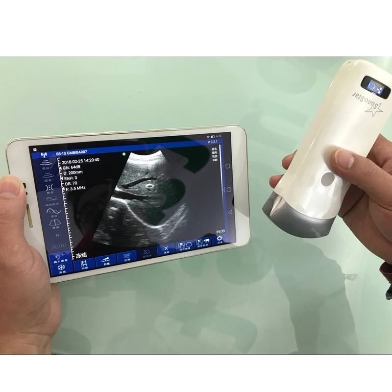 UProbe-3C портативная ультразвуковая машина медицинские ультразвуковые инструменты