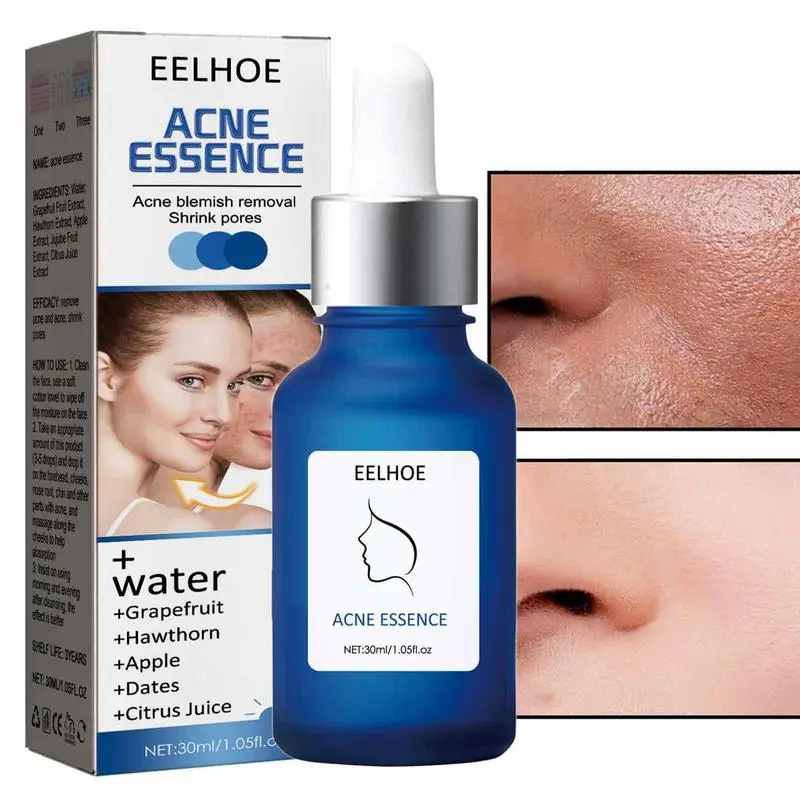 

Pore Shrinking Essence Skin Pimple Repair Moisturizer For Face 30ml Face Essence Hydrating Serums For Pimples Blackheads Beauty